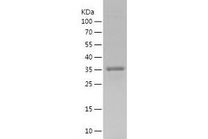 Western Blotting (WB) image for Solute Carrier Family 2 (Facilitated Glucose Transporter), Member 3 (SLC2A3) (AA 449-496) protein (His-IF2DI Tag) (ABIN7282338) (SLC2A3 Protein (AA 449-496) (His-IF2DI Tag))