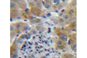Used in DAB staining on fromalin fixed paraffin-embedded Liver tissue (CSF3R antibody  (AA 26-138))