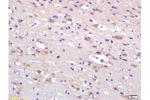 Formalin-fixed and paraffin embedded rat brain labeled with Anti-HIP2 Polyclonal Antibody, Unconjugated (ABIN1387369) at 1:200 followed by conjugation to the secondary antibody and DAB staining. (UBE2K antibody  (AA 51-150))