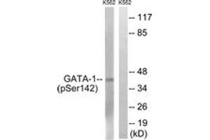 Western blot analysis of extracts from K562 cells, using GATA1 (Phospho-Ser142) Antibody. (GATA1 antibody  (pSer142))