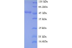 ATP Synthase, H+ Transporting, Mitochondrial F1 Complex, O Subunit (ATP5O) (AA 24-213) protein (GST tag)