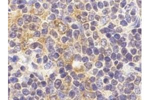 Immunohistochemistry of TLR9 in mouse spleen cells with this product at 2 μg/ml. (TLR9 antibody  (C-Term))