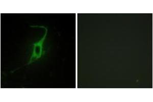 Immunofluorescence analysis of NIH-3T3 cells, using CDH20 Antibody. (Cadherin 20 antibody  (AA 111-160))