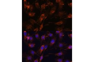 Immunofluorescence analysis of C6 cells using SC antibody (ABIN7270188) at dilution of 1:100. (SCAMP2 antibody  (AA 1-152))