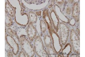 Image no. 4 for anti-Mitofusin 2 (MFN2) (AA 661-758) antibody (ABIN599101) (MFN2 antibody  (AA 661-758))