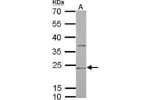 WB Image CD74 antibody [N1N2], N-term detects CD74 protein by Western blot analysis. (CD74 antibody  (N-Term))