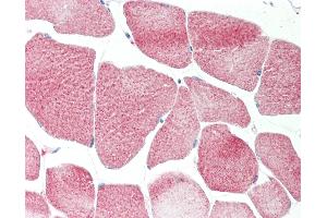 Human Skeletal Muscle: Formalin-Fixed, Paraffin-Embedded (FFPE). (RRP8 antibody  (AA 89-138))