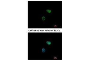 ICC/IF Image Immunofluorescence analysis of paraformaldehyde-fixed HeLa, using PSMC6, antibody at 1:500 dilution. (PSMC6 antibody)
