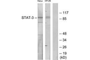 Western blot analysis of extracts from HeLa/HT-29 cells, using STAT3 (Ab-727) Antibody. (STAT3 antibody  (AA 694-743))