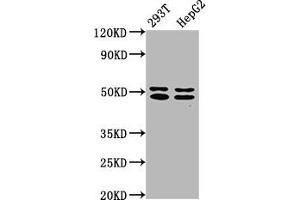 Western Blot Positive WB detected in: 293T whole cell lysate, HepG2 whole cell lysate All lanes: TRNT1 antibody at 5 μg/mL Secondary Goat polyclonal to rabbit IgG at 1/50000 dilution Predicted band size: 51, 48, 7 kDa Observed band size: 51, 48 kDa (Trnt1 antibody  (AA 128-293))