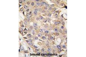 Immunohistochemistry (IHC) image for anti-Mitogen-Activated Protein Kinase 3 (MAPK3) antibody (ABIN3003251)