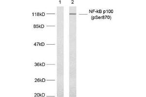 Western blot analysis of extract from MDA-MB-435 cells untreated or treated with TNF-alpha, (20 ng/mL, 5 min) using NF-κ,B p100(phospho-Ser870) antibody. (NFKB2 antibody  (pSer870))