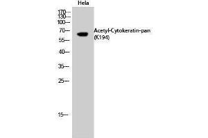 Western Blotting (WB) image for anti-Keratin 1 (KRT1) (acLys194) antibody (ABIN3181898) (Cytokeratin 1 antibody  (acLys194))