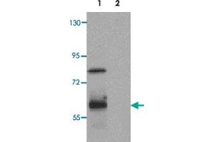Western blot analysis of RASSF10 in human lung tissue lysate with RASSF10 polyclonal antibody  at 1 ug/mL.