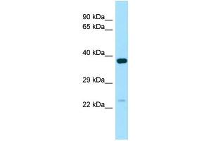 WB Suggested Anti-NXNL1 Antibody Titration: 1. (NXNL1 antibody  (C-Term))