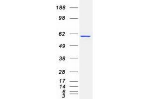 Validation with Western Blot (CRMP1 Protein (Transcript Variant 2) (Myc-DYKDDDDK Tag))