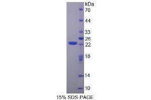 SDS-PAGE (SDS) image for Antigen Identified By Monoclonal Antibody Ki-67 (MKI67) (AA 3088-3235) protein (His tag) (ABIN1080172) (Ki-67 Protein (AA 3088-3235) (His tag))