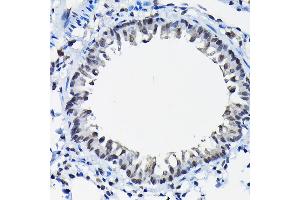 Immunohistochemistry of paraffin-embedded rat lung using SSN Rabbit pAb (3377) at dilution of 1:100 (40x lens).