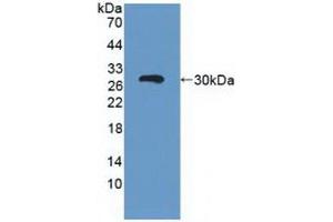 Detection of Recombinant ABCC3, Human using Polyclonal Antibody to ATP Binding Cassette Transporter C3 (ABCC3) (ABCC3 antibody  (AA 1291-1523))