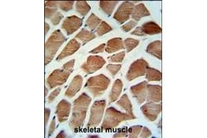 CA5B Antibody (C-term) (ABIN652315 and ABIN2841444) IHC analysis in formalin fixed and paraffin embedded human skeletal muscle followed by peroxidase conjugation of the secondary antibody and DAB staining. (CA5B antibody  (C-Term))