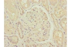 Immunohistochemistry of paraffin-embedded human kidney tissue using ABIN7148059 at dilution of 1:100 (CCHCR1 antibody  (AA 483-782))