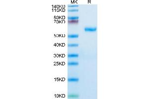 Human RNF43 on Tris-Bis PAGE under reduced condition.