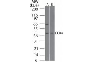 Image no. 1 for anti-Chemokine (C-C Motif) Receptor 4 (CCR4) (AA 337-351) antibody (ABIN1100490) (CCR4 antibody  (AA 337-351))