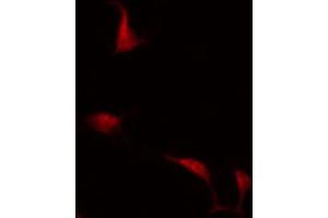 ABIN6266862 staining COLO205 by IF/ICC. (MAPKAP Kinase 3 antibody  (C-Term))