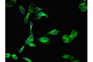 Immunofluorescent analysis of Hela cells using ABIN7169176 at dilution of 1:100 and Alexa Fluor 488-congugated AffiniPure Goat Anti-Rabbit IgG(H+L) (SGK1 antibody  (AA 247-406))