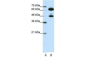 WB Suggested Anti-SNRP70  Antibody Titration: 0. (SNRNP70 antibody  (C-Term))