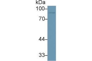 Detection of MMP9 in Human U937 cell lysate using Monoclonal Antibody to Matrix Metalloproteinase 9 (MMP9) (MMP 9 antibody  (AA 213-399))