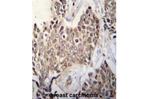 ZBTB42 Antibody (N-term) immunohistochemistry analysis in formalin fixed and paraffin embedded human breast tissue followed by peroxidase conjugation of the secondary antibody and DAB staining. (ZBTB42 antibody  (N-Term))
