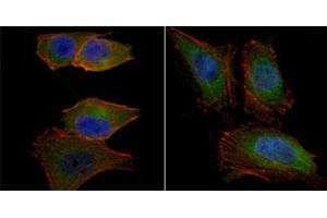 Immunofluorescence staining of PANC-1 (left) and HeLa (right) cells. (AKT2 antibody)