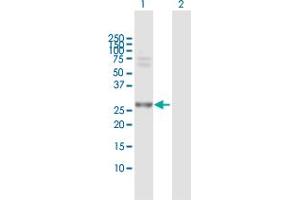 Western Blot analysis of PSMA7 expression in transfected 293T cell line by PSMA7 MaxPab polyclonal antibody. (PSMA7 antibody  (AA 1-248))