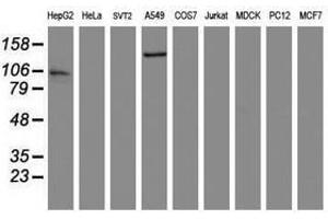 Image no. 2 for anti-ATP/GTP Binding Protein 1 (AGTPBP1) (AA 368-753) antibody (ABIN1491462)
