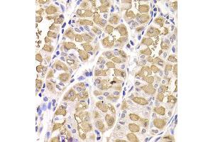 Immunohistochemistry of paraffin-embedded Human gastric using RAMP1 antibody at dilution of 1:100 (x400 lens).