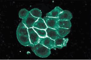 Immunofluorescence staining of WiDr cells (Human colorectal adenocarcinoma, ATCC CCL-218). (ITGA2 antibody  (AA 42-245))