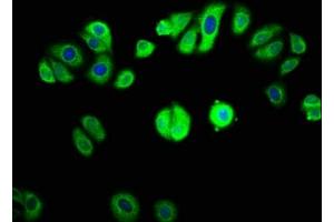 Immunofluorescence staining of HepG2 cells with  at 1:133, counter-stained with DAPI. (GAB1 antibody  (AA 119-329))