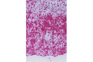 Detection of HEL at Human atherosclerotic lesions. (N epsilon Hexanoyl-Keyhole Limpet Hemocyanin (HEL-KLH) antibody)