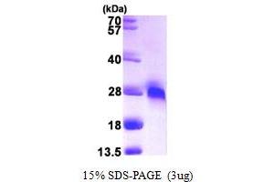 SDS-PAGE (SDS) image for gamma-Glutamylcyclotransferase (GGCT) (AA 1-188) protein (His tag) (ABIN667336) (GGCT Protein (AA 1-188) (His tag))
