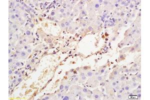 Formalin-fixed and paraffin embedded rat liver tissue labeled with Anti-Transferrin Polyclonal Antibody, Unconjugated (ABIN677048) at 1:200 followed by conjugation to the secondary antibody and DAB staining (Transferrin antibody)