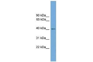 WB Suggested Anti-ZDHHC18 Antibody Titration:  0. (ZDHHC18 antibody  (Middle Region))