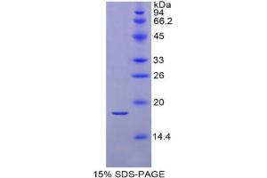 SDS-PAGE analysis of Mouse RBP2 Protein. (RBP2 Protein)
