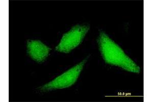 Immunofluorescence of purified MaxPab antibody to CPXCR1 on HeLa cell. (CPXCR1 antibody  (AA 1-301))