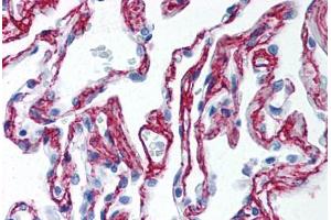 Human Lung (formalin-fixed, paraffin-embedded) stained with Collagen VI antibody ABIN364508 at 2. (COL6 antibody)