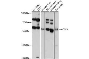 Western blot analysis of extracts of various cell lines, using  antibody (ABIN6131462, ABIN6136454, ABIN6136455 and ABIN6217879) at 1:3000 dilution. (ACSF3 antibody  (AA 270-450))