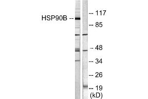 Western blot analysis of Human Cervical cancer cell line (HeLa) lysate showing detection of ~90 kDa Hsp90 beta protein using Rabbit Anti-Hsp90 beta Polyclonal Antibody . (SMAD3 antibody  (AA 1-100) (FITC))