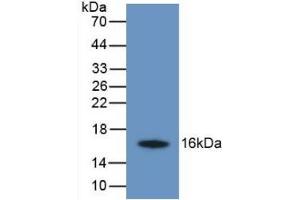Detection of Recombinant TMEM27, Human using Monoclonal Antibody to Transmembrane Protein 27 (TMEM27) (TMEM27 antibody  (AA 17-137))