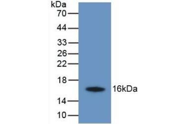 TMEM27 Antikörper  (AA 17-137)