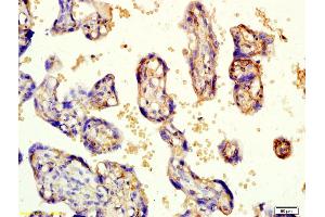 Formalin-fixed and paraffin embedded human placenta labeled with Rabbit Anti-KCNK3 Polyclonal Antibody, Unconjugated (ABIN682333) at 1:200 followed by conjugation to the secondary antibody and DAB staining (KCNK3 antibody  (AA 181-280))